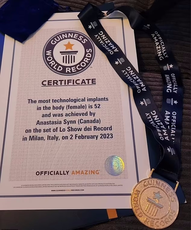 زن شعبده باز رکورددار بیشترین ایمپلنت تکنولوژیکی در بدن + ویدئو