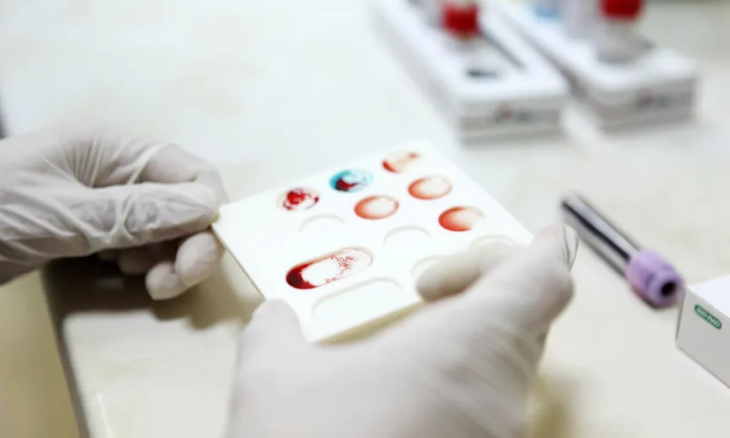 آزمایش خون سریع و ارزانی که ممکن است سرطان را قبل از پیدایش علائم تشخیص دهد 1 آزمایش خون سریع و ارزانی که ممکن است سرطان را.webp