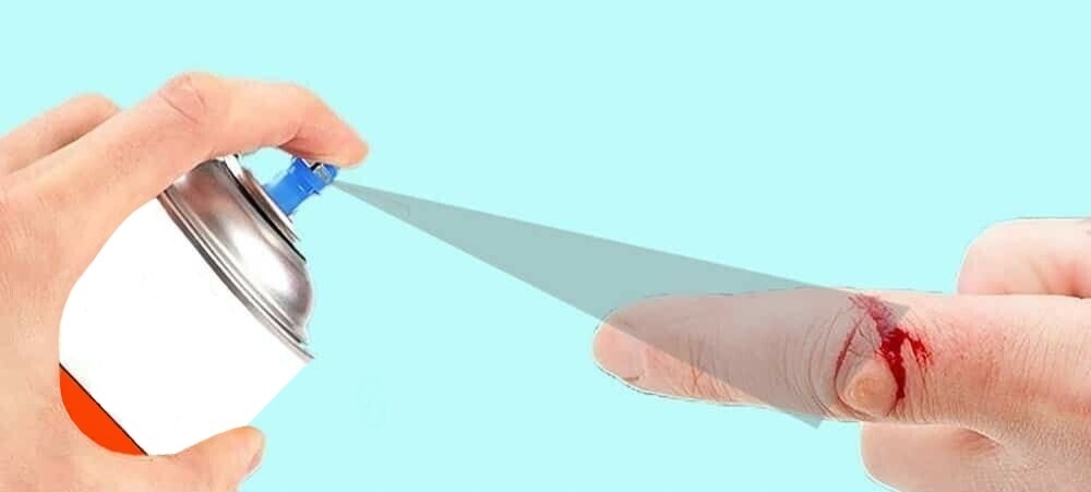 توقف خونریزی در ۳۰ ثانیه ممکن شد/ انقلاب جدید دانشمندان ایرانی در فناوری پزشکی توقف خونریزی در ۳۰ ثانیه ممکن شد/ انقلاب جدید دانشمندان ایرانی در فناوری پزشکی