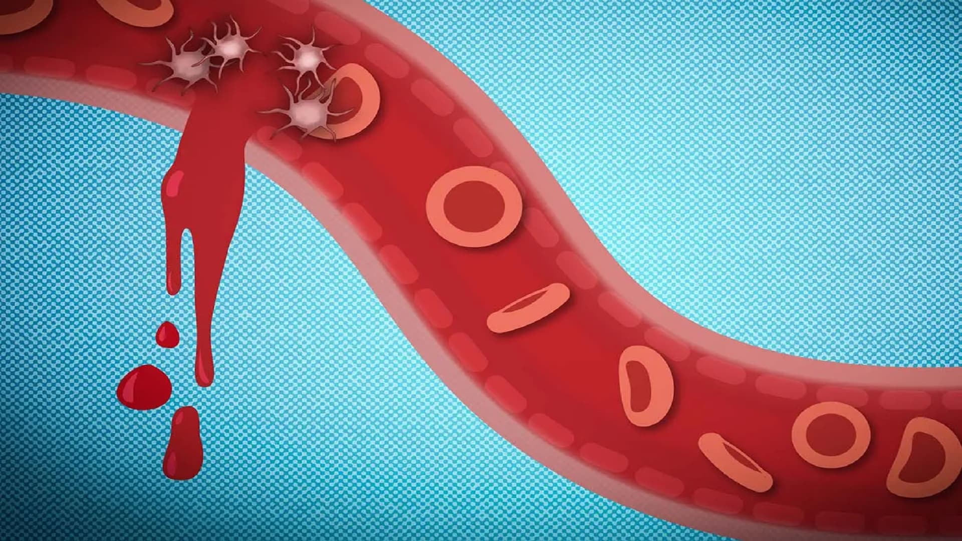 توقف خونریزی در ۳۰ ثانیه ممکن شد/ انقلاب جدید دانشمندان ایرانی در فناوری پزشکی توقف خونریزی در ۳۰ ثانیه ممکن شد/ انقلاب جدید دانشمندان ایرانی در فناوری پزشکی