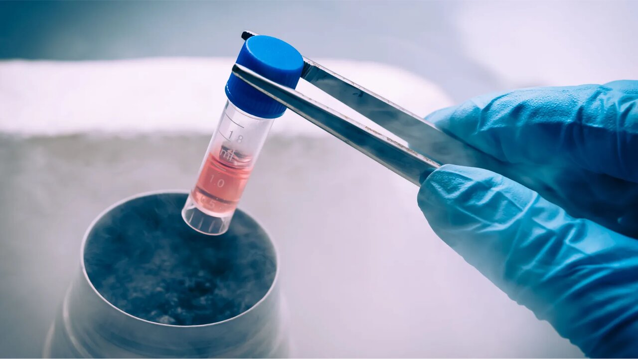 پشت‌ صحنه لقاح مصنوعی در ایران؛ روایتی از امید و انتخاب‌های دشوار