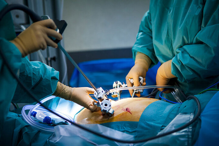 چاقی از کودکی آغاز می‌شود؛ تهدیدی جدی برای سلامت کشور